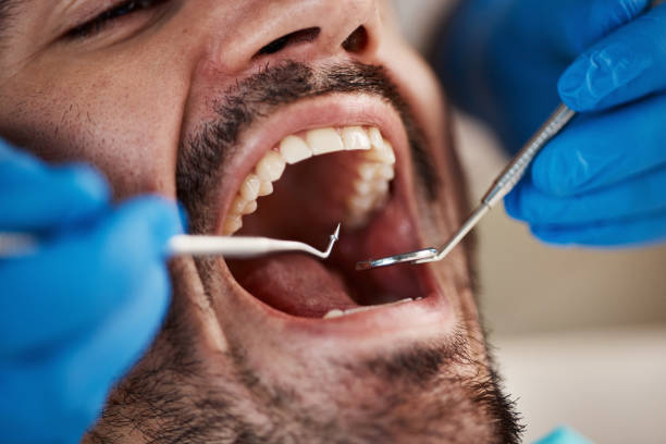 Best Emergency Gum Pain Relief  in Country Club Hls, IL